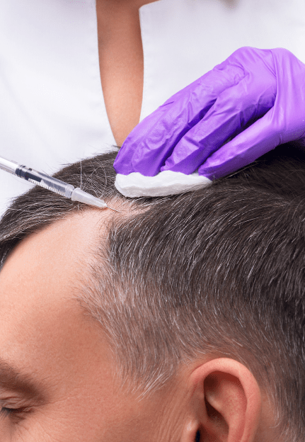  Cosmetic Hair Patches